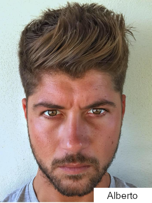 Alberto